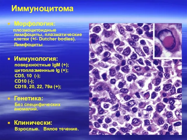 Иммуноцитома Морфология: плозмоцитоидные лимфоциты, плазматические клетки (+/- Dutcher bodies). Лимфоциты Иммунология: