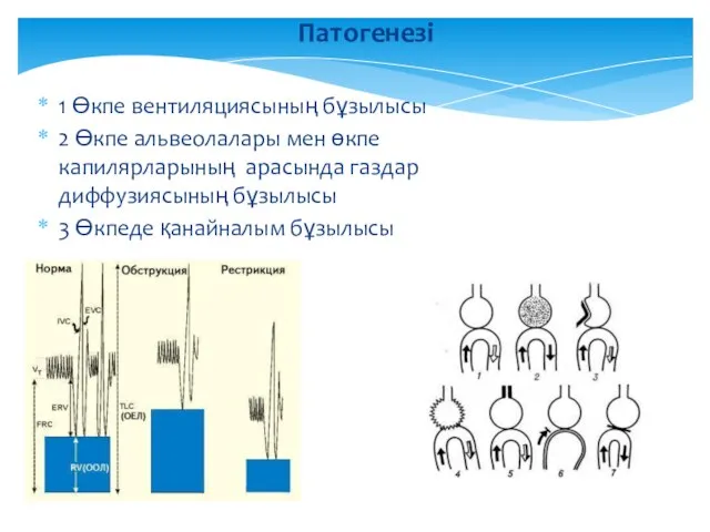 1 Өкпе вентиляциясының бұзылысы 2 Өкпе альвеолалары мен өкпе капилярларының арасында