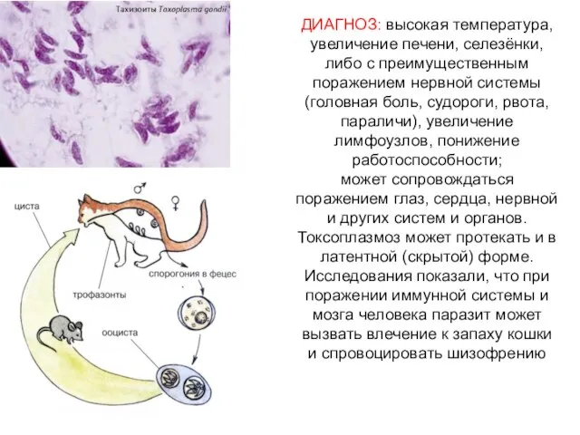 ДИАГНОЗ: высокая температура, увеличение печени, селезёнки, либо с преимущественным поражением нервной