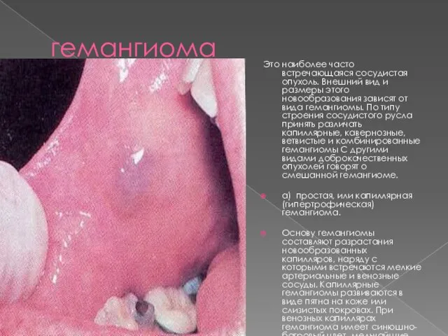 гемангиома Это наиболее часто встречающаяся сосудистая опухоль. Внешний вид и размеры