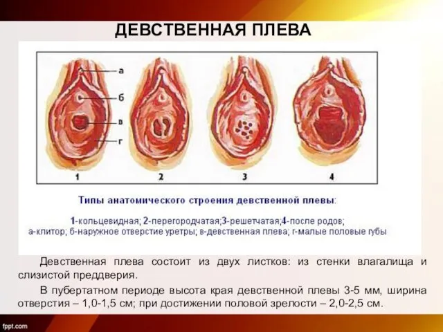 ДЕВСТВЕННАЯ ПЛЕВА Девственная плева состоит из двух листков: из стенки влагалища