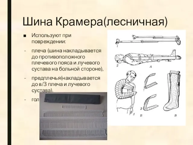 Шина Крамера(лесничная) Используют при повреждении: плеча (шина накладывается до противоположного плечевого