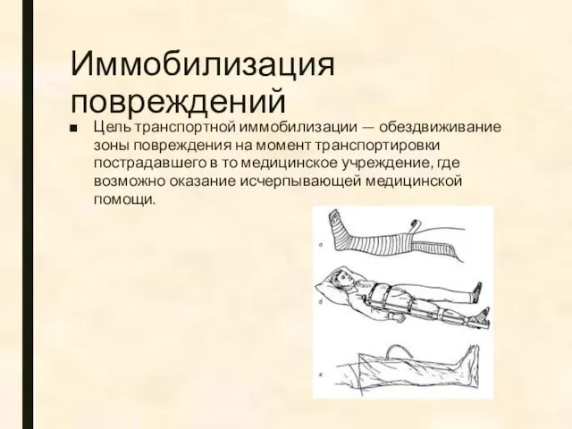 Иммобилизация повреждений Цель транспортной иммобилизации — обездвиживание зоны повреждения на момент