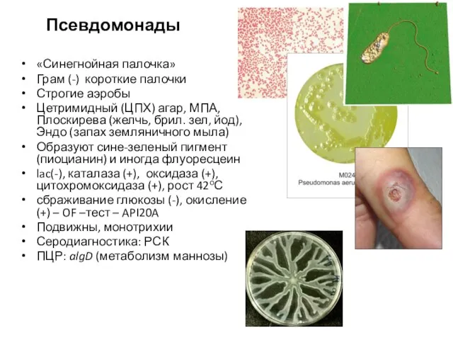 Псевдомонады «Синегнойная палочка» Грам (-) короткие палочки Строгие аэробы Цетримидный (ЦПХ)