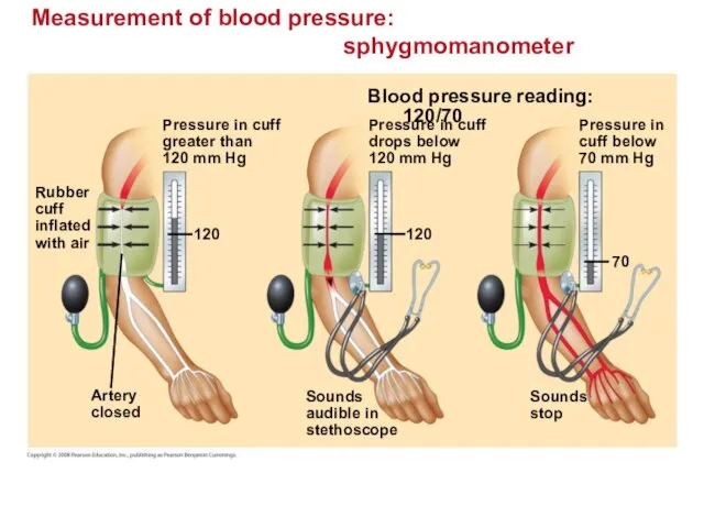 Measurement of blood pressure: sphygmomanometer Pressure in cuff greater than 120