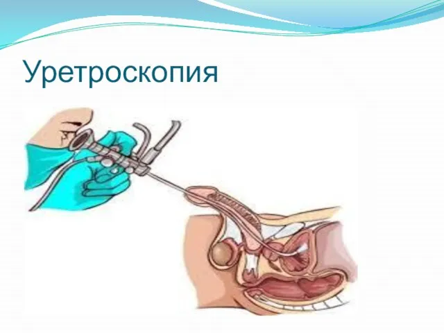 Уретроскопия