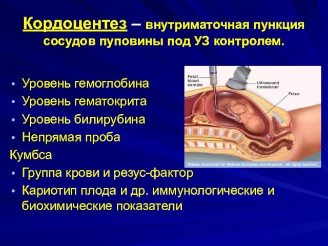 Кордоцентез – внутриматочная пункция сосудов пуповины под УЗ контролем. Уровень гемоглобина