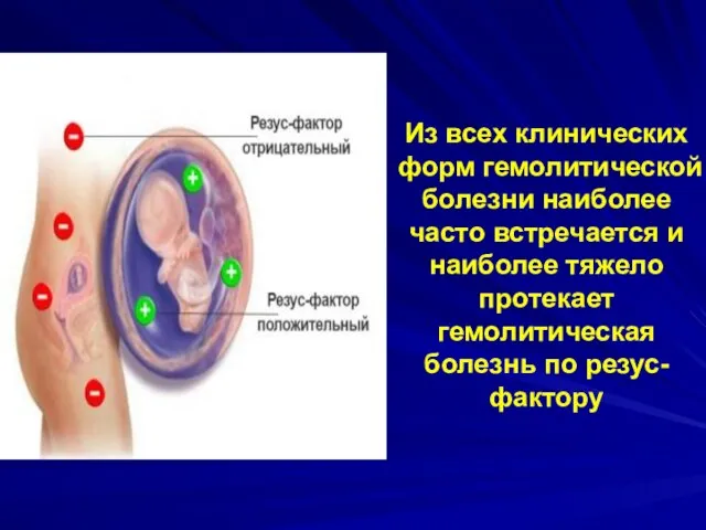 Из всех клинических форм гемолитической болезни наиболее часто встречается и наиболее