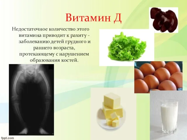 Витамин Д Недостаточное количество этого витамина приводит к рахиту - заболеванию