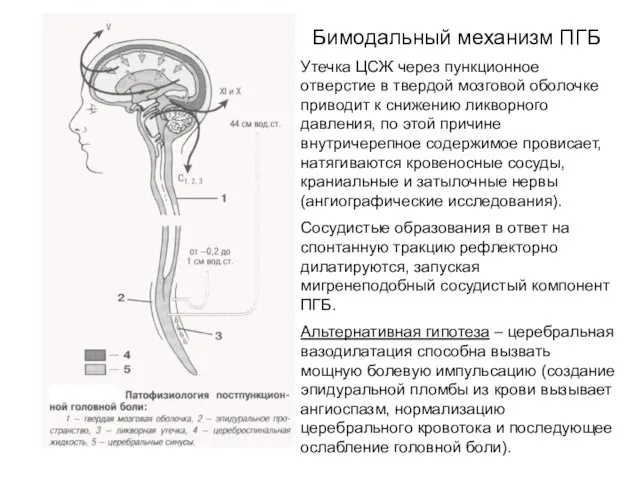 Бимодальный механизм ПГБ Утечка ЦСЖ через пункционное отверстие в твердой мозговой