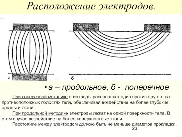 Расположение электродов. а – продольное, б - поперечное При поперечной методике