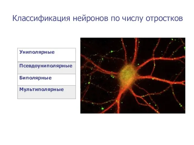 Классификация нейронов по числу отростков