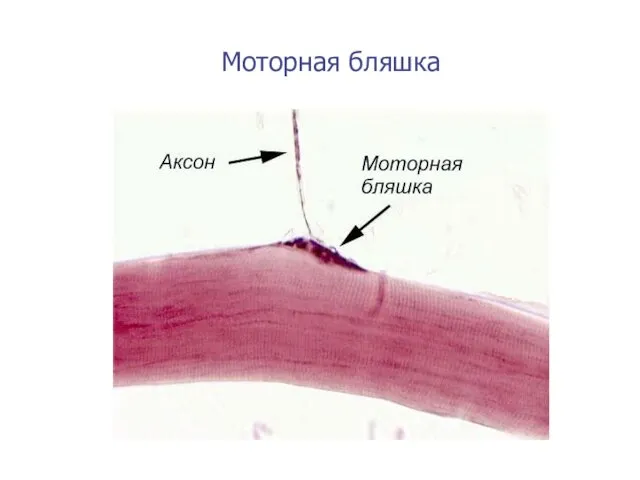 Моторная бляшка