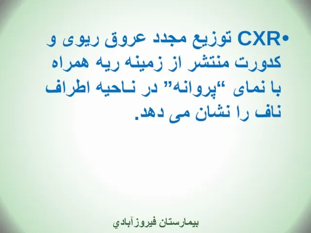 CXR توزیع مجدد عروق ریوی و کدورت منتشر از زمینه ریه