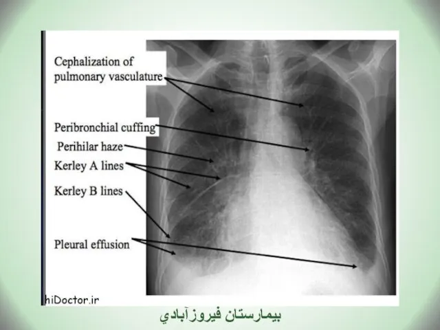 بيمارستان فيروزآبادي