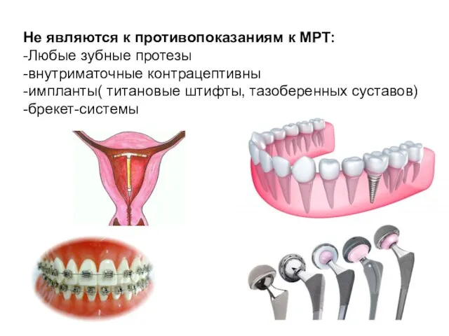 Не являются к противопоказаниям к МРТ: -Любые зубные протезы -внутриматочные контрацептивны