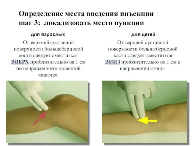 Определение места введения инъекции шаг 3: локализовать место пункции От верхней