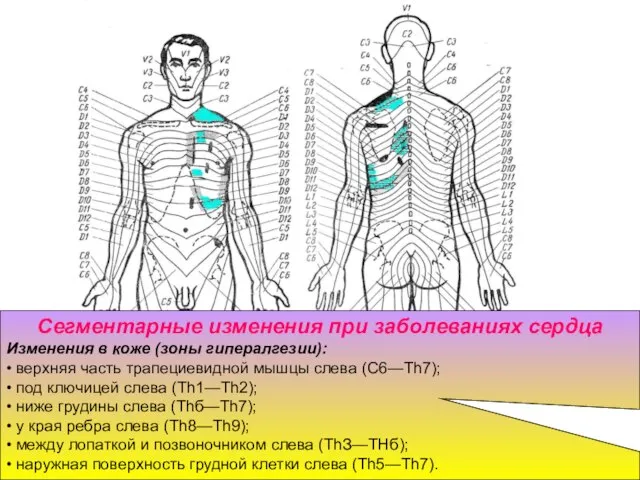 Сегментарные изменения при заболеваниях сердца Изменения в коже (зоны гипералгезии): •