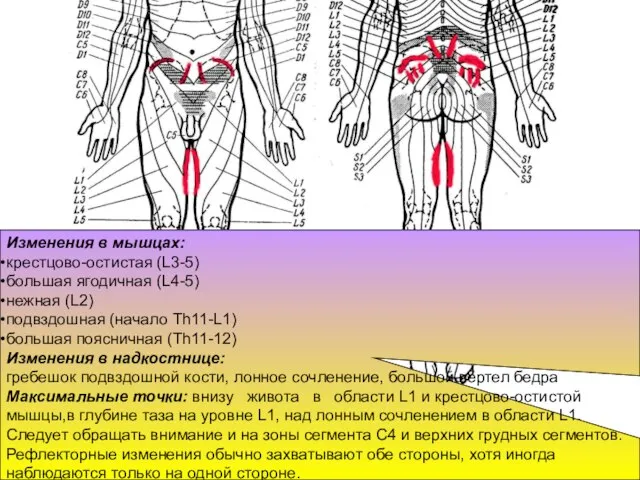 Изменения в мышцах: крестцово-остистая (L3-5) большая ягодичная (L4-5) нежная (L2) подвздошная
