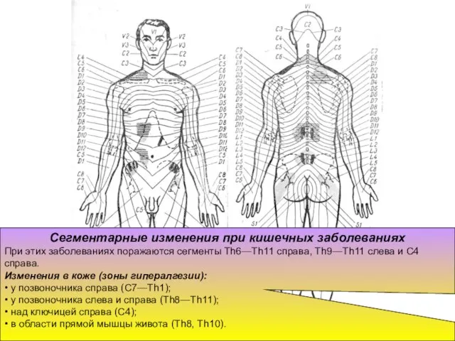 Сегментарные изменения при кишечных заболеваниях При этих заболеваниях поражаются сегменты Th6—Th11