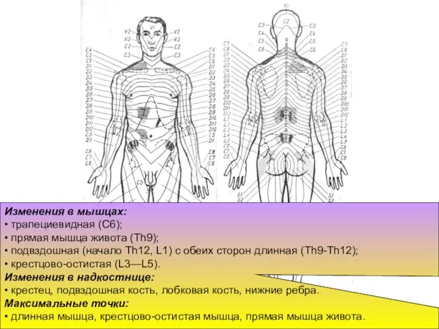 Изменения в мышцах: • трапециевидная (С6); • прямая мышца живота (Th9);