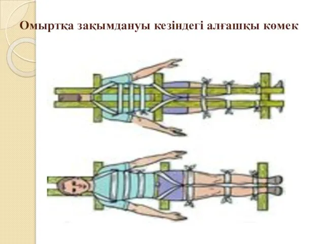 Омыртқа зақымдануы кезіндегі алғашқы көмек