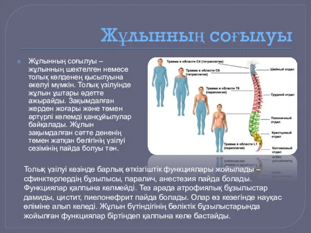 Жұлынның соғылуы Жұлынның соғылуы – жұлынның шектелген немесе толық көлденең қысылуына