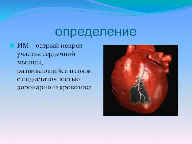 определение ИМ – острый некроз участка сердечной мышцы, развивающийся в связи с недостаточностью коронарного кровотока