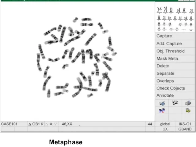 Metaphase chromosomes