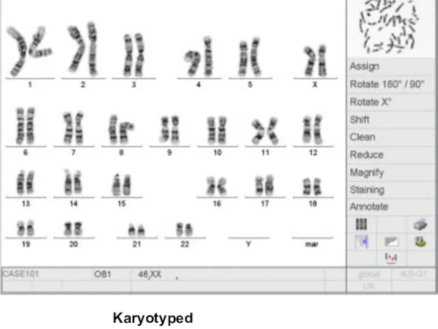 Karyotyped chromosomes