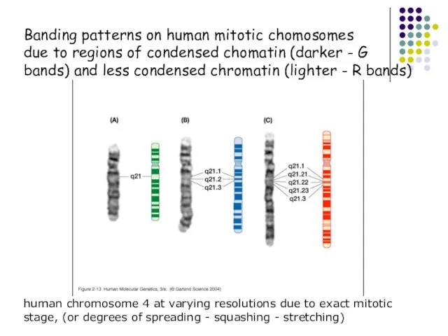 Banding patterns on human mitotic chomosomes due to regions of condensed
