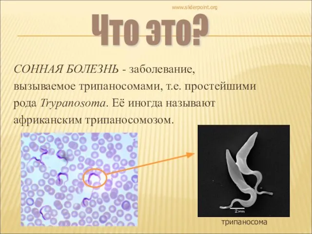 СОННАЯ БОЛЕЗНЬ - заболевание, вызываемое трипаносомами, т.е. простейшими рода Trypanosoma. Её