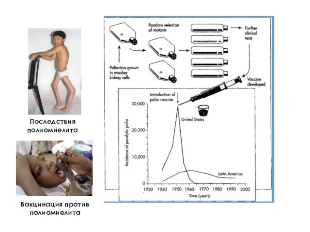 Последствия полиомиелита Вакцинация против полиомиелита