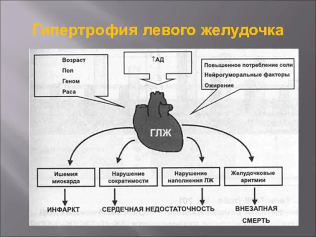 Гипертрофия левого желудочка