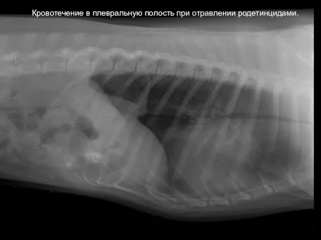 Кровотечение в плевральную полость при отравлении родетинцидами. Кровотечение в плевральную полость при отравлении родетинцидами.