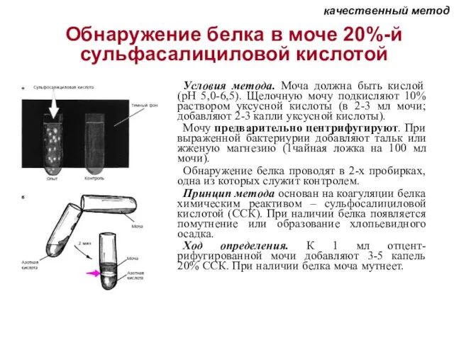 Условия метода. Моча должна быть кислой (pH 5,0-6,5). Щелочную мочу подкисляют