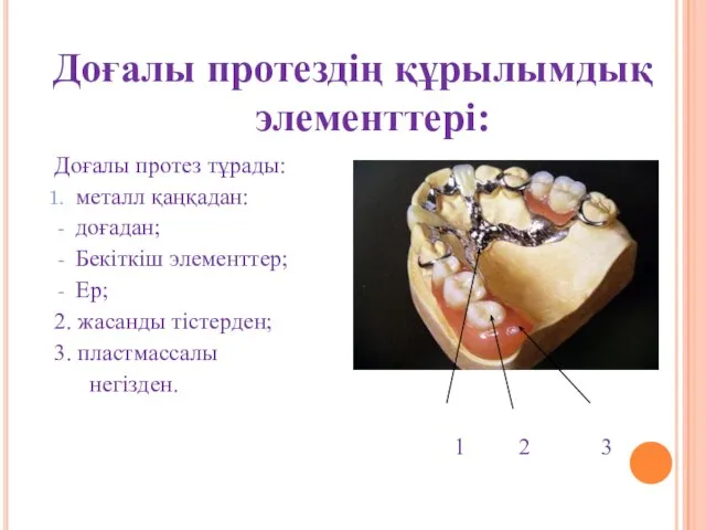 Доғалы протездің құрылымдық элементтері: Доғалы протез тұрады: металл қаңқадан: доғадан; Бекіткіш