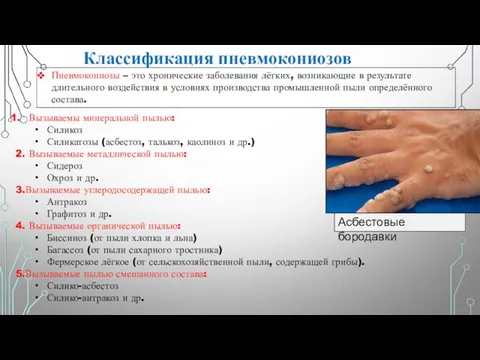 Классификация пневмокониозов Пневмокониозы – это хронические заболевания лёгких, возникающие в результате