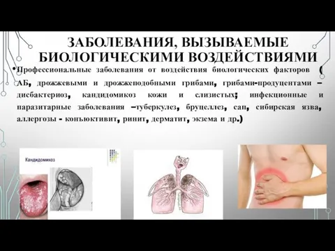 ЗАБОЛЕВАНИЯ, ВЫЗЫВАЕМЫЕ БИОЛОГИЧЕСКИМИ ВОЗДЕЙСТВИЯМИ Профессиональные заболевания от воздействия биологических факторов (