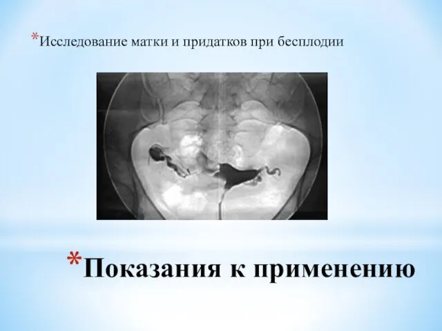 Показания к применению Исследование матки и придатков при бесплодии