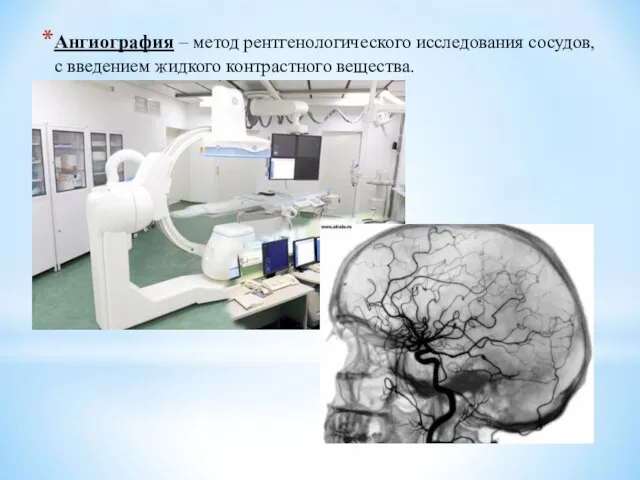 Ангиография – метод рентгенологического исследования сосудов, с введением жидкого контрастного вещества.