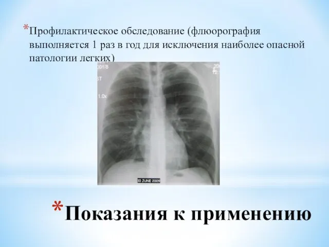 Показания к применению Профилактическое обследование (флюорография выполняется 1 раз в год