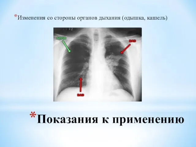 Показания к применению Изменения со стороны органов дыхания (одышка, кашель)