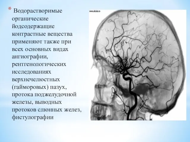 Водорастворимые органические йодсодержащие контрастные вещества применяют также при всех основных видах