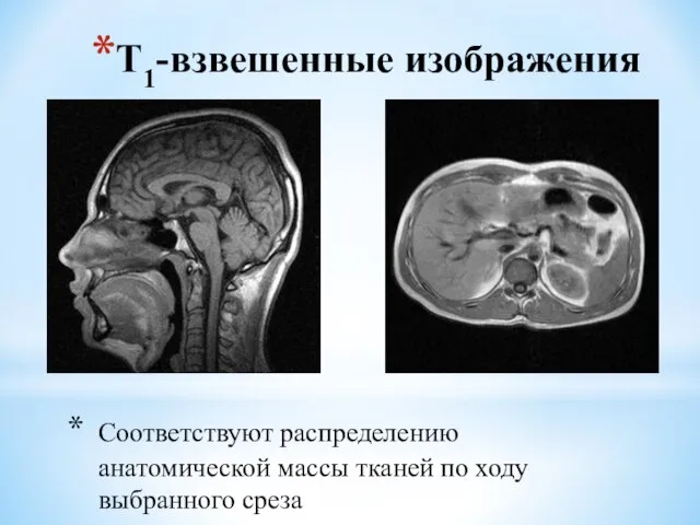 Т1-взвешенные изображения Соответствуют распределению анатомической массы тканей по ходу выбранного среза