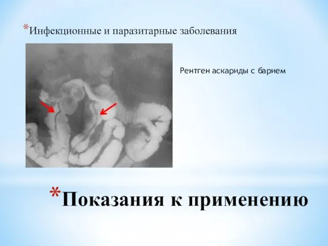 Показания к применению Инфекционные и паразитарные заболевания Рентген аскариды с барием