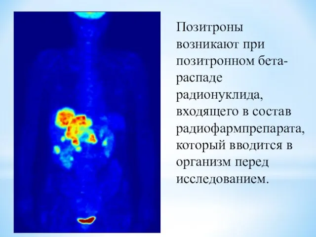 Позитроны возникают при позитронном бета-распаде радионуклида, входящего в состав радиофармпрепарата, который вводится в организм перед исследованием.