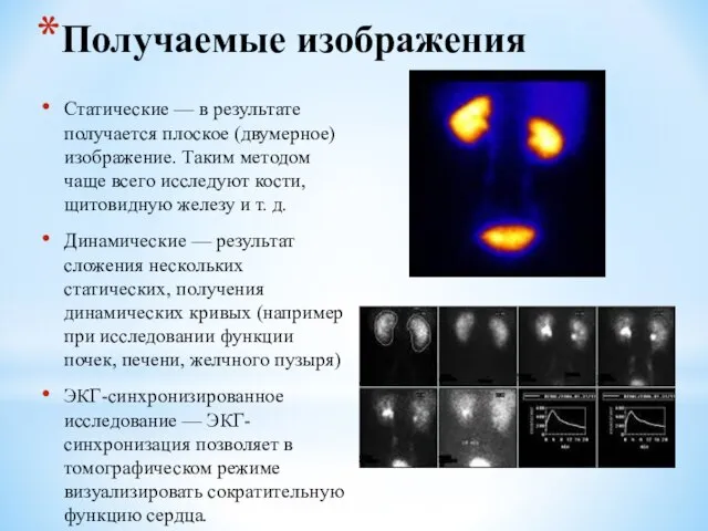 Получаемые изображения Статические — в результате получается плоское (двумерное) изображение. Таким