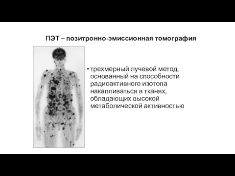 ПЭТ – позитронно-эмиссионная томография трехмерный лучевой метод, основанный на способности радиоактивного