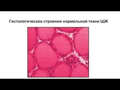 Гистологическое строение нормальной ткани ЩЖ